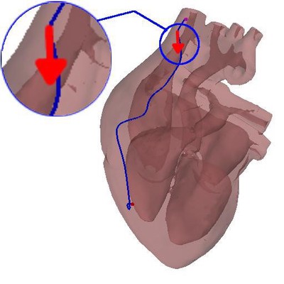 Exploring the Heart Model